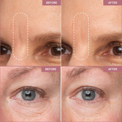 Peptiject™ Peptide-Infused Face & Eye Tape